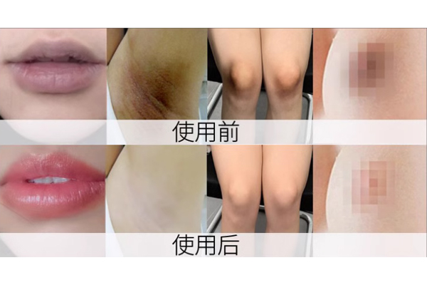女性必看!教你如何将下面变粉红色 女性必看!教你如何将下面变粉红色