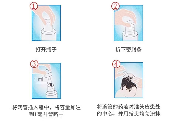 印度hair4u生发液的正确使用方法指南 印度hair4u生发液的正确使用方法指南