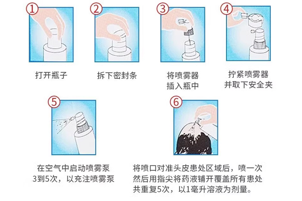 印度hair4u生发液的正确使用方法指南 印度hair4u生发液的正确使用方法指南
